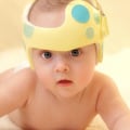 Can You Fix a Baby's Flat Head Without a Helmet?