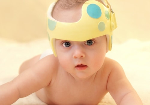 Can You Fix a Baby's Flat Head Without a Helmet?